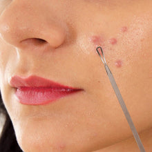 Load image into Gallery viewer, 7-Pieces: Blackhead Remover Stainless Steel
