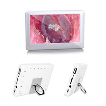 Load image into Gallery viewer, 3.9MM HD1080P 2MP Ear Cleaner With 4.3 inch Screen Otoscope Camera Endoscope Camera Digital Otoscope Ear Monitor Earpick