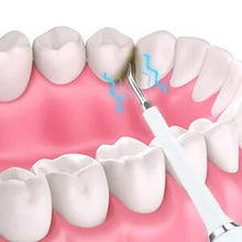 Load image into Gallery viewer, Electric Sonic Dental Calculus Scaler Oral Teeth Tartar Remover Plaque Stains Cleaner Removal Teeth Whitening Portable IPX7 New