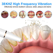 Load image into Gallery viewer, Ultrasonic Dental Scaler For Teeth Tartar Stain Tooth Calculus Remover Electric Sonic Teeth Plaque Cleaner Dental Stone Removal