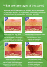 Load image into Gallery viewer, 1Pc Alginate Medical Dressing Wound Dressing Sterile Hemostatic Thin Healing Pad Hydrocolloid Adhesive Patch