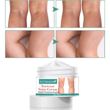 Load image into Gallery viewer, Varicose Deep Nourishing Soothing Vein Cream