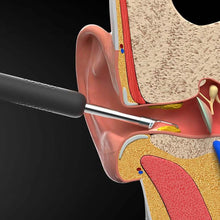 Load image into Gallery viewer, Bebird R1 Wireless Intelligent Visual Otoscope Ear Cleaner