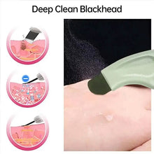 Load image into Gallery viewer, Blackhead Remover Tool Extractor
