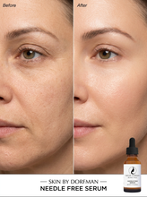 Load image into Gallery viewer, Needle Free Serum