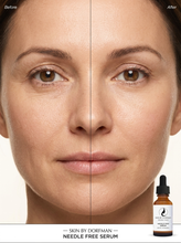 Load image into Gallery viewer, Needle Free Serum