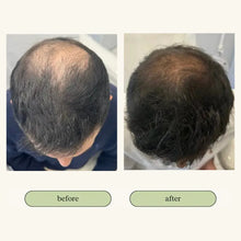 Load image into Gallery viewer, Vital Hair Trio Bundle
