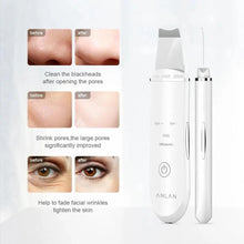 Load image into Gallery viewer, Ultrasonic Derma Skin Scrubber Pen for Face Cleansing Dead Skin Cleaner - Skin Care Tools Beauty Modern Tool