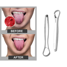 Load image into Gallery viewer, 2-Pack: Stainless Steel Tongue Cleaner Scraper
