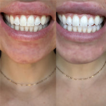 Load image into Gallery viewer, Teeth Whitening Strips

