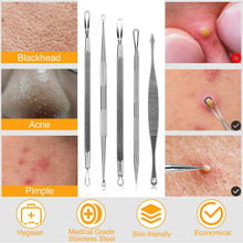 Load image into Gallery viewer, 5-Piece Set: Blackhead Remover Kit Stainless Steel Popping Zit Remover
