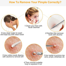 Load image into Gallery viewer, 7-Pieces: Blackhead Remover Stainless Steel
