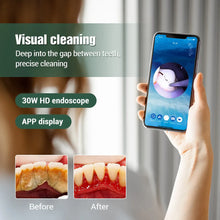 Load image into Gallery viewer, Ultrasonic Dental Scaler Electric Visual Teeth Cleaner Tooth Whitening Sonic Stone Plaque Scalers Tartar Stains Calculus Remover
