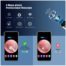 Load image into Gallery viewer, Wireless Smart Visual Ear Cleaner Otoscope NP20 Ear Wax Removal Tool with Camera Ear Endoscope 1080P Kit for iPhone iPad Android
