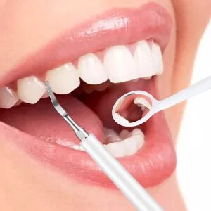 Electric Sonic Dental Calculus Scaler Oral Teeth Tartar Remover Plaque Stains Cleaner Removal Teeth Whitening Portable IPX7 New