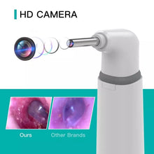 Load image into Gallery viewer, 3.9mm WIFI Visual Digital Otoscope Ear Endoscope Camera Medical Ear Wax Cleaner Camera for Ears Nose Dental Support IOS Android
