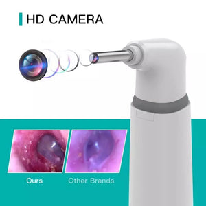 3.9mm WIFI Visual Digital Otoscope Ear Endoscope Camera Medical Ear Wax Cleaner Camera for Ears Nose Dental Support IOS Android
