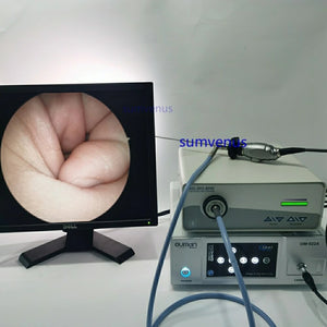 HD 2.7mm 4mm 0 30 45 70 90 degree Medical Surgical Rigid Endoscope Sinusoscope ENT Endoscopy Camera