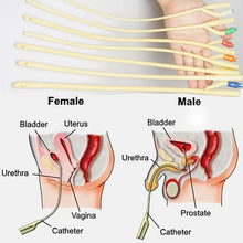 Load image into Gallery viewer, Penis Plug,Urethral Sounding Bladder Dildator Catheter Sound Dilation,Urethra Urethale Dilator Uretal,Uretra Urethera Probe
