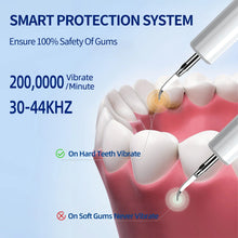 Load image into Gallery viewer, Xiaomi Youpin Electric Dental Scaler Ultrasonic Tooth Cleaner Household Tooth Stone Remover Tooth Whitening Oral Cleaning Tools
