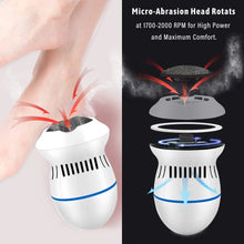 Load image into Gallery viewer, Electric Foot File Rupture Skin Trimmer Dead Skin Foot Professional Electric Pedicure ToolsRechargeable Foot Care Tools

