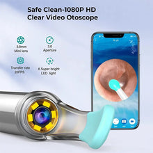 Load image into Gallery viewer, Ear Wax Cleaner Smart Ear Cleaner Otoscope Ear Wax Removal Tool with Camera Ear Endoscope 1080P Kit for iPhone iPad Android
