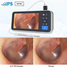 Load image into Gallery viewer, Otoscope 4.5&quot; Screen  Camera 1080P HD 3.9mm Ent Endoscope Digital Medical Ear Inspection Scope Visual Earwax Removal Tool
