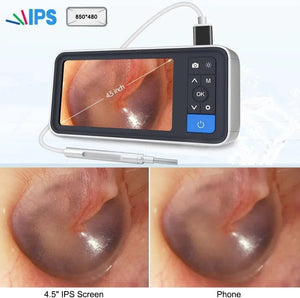 Otoscope 4.5" Screen  Camera 1080P HD 3.9mm Ent Endoscope Digital Medical Ear Inspection Scope Visual Earwax Removal Tool