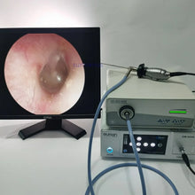 Load image into Gallery viewer, HD 2.7mm 4mm 0 30 45 70 90 degree Medical Surgical Rigid Endoscope Sinusoscope ENT Endoscopy Camera
