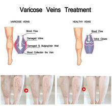 Load image into Gallery viewer, Varicose Deep Nourishing Soothing Vein Cream
