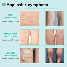 Load image into Gallery viewer, Varicose Deep Nourishing Soothing Vein Cream
