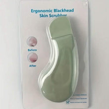 Load image into Gallery viewer, Blackhead Remover Tool Extractor
